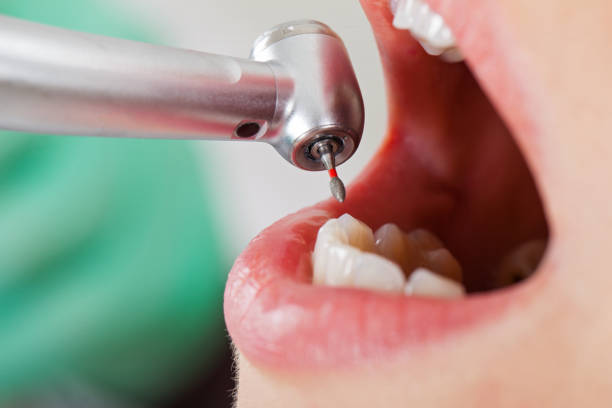 Best Emergency Dental Care for Broken or Chipped Teeth in Greenbrier, AR